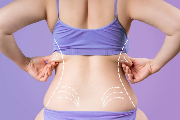 Aqualyx Treatment