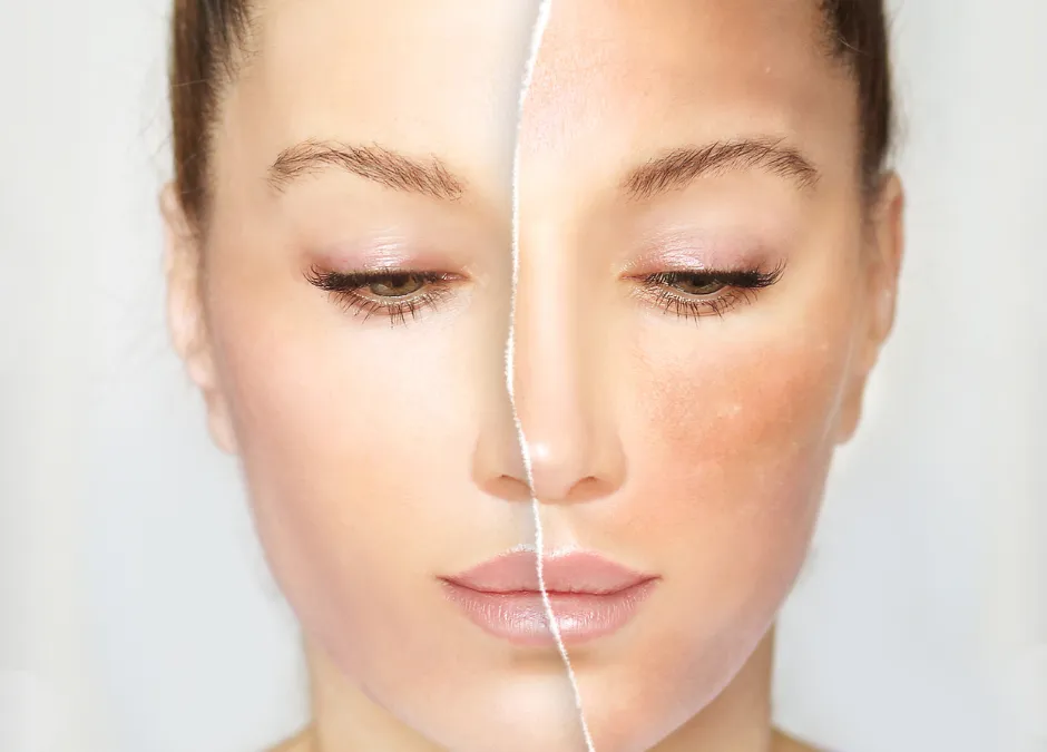 Benefits of Glutathione IV Therapy