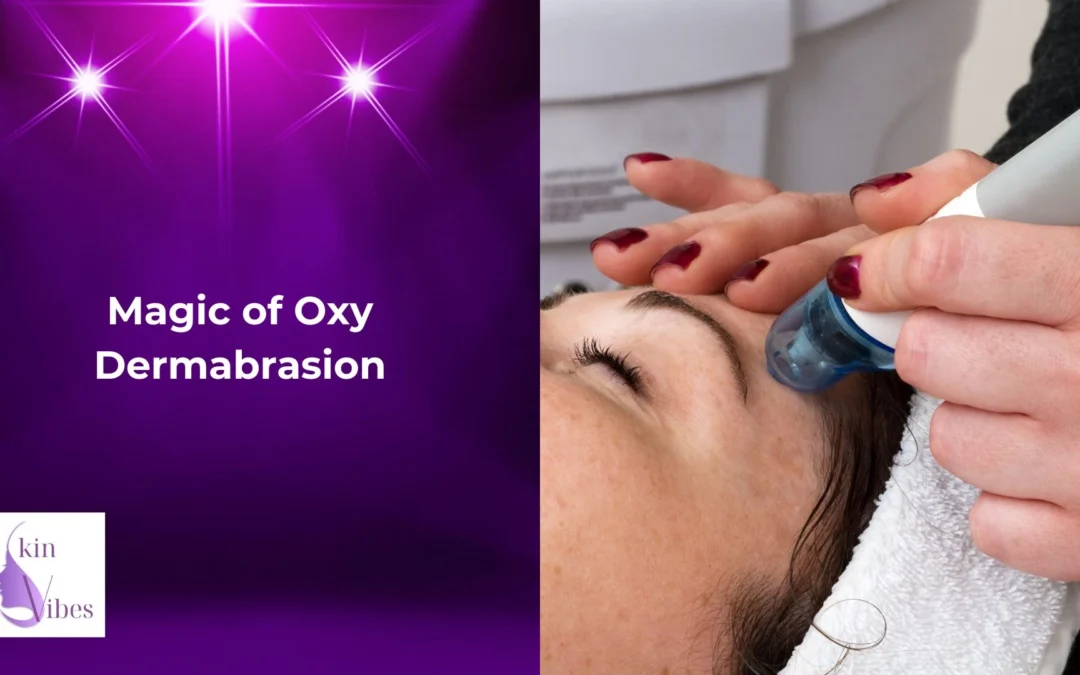 Unveiling the Magic of Oxy Dermabrasion: Transform Your Skin with Radiance