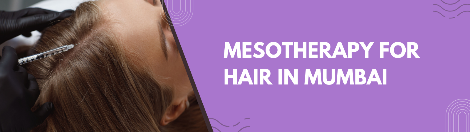 Mesotherapy for hair in Mumbai