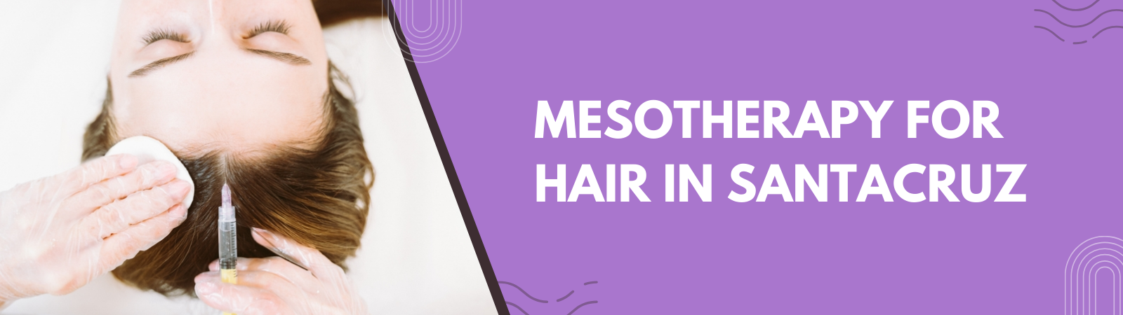 Mesotherapy for hair in Santacruz