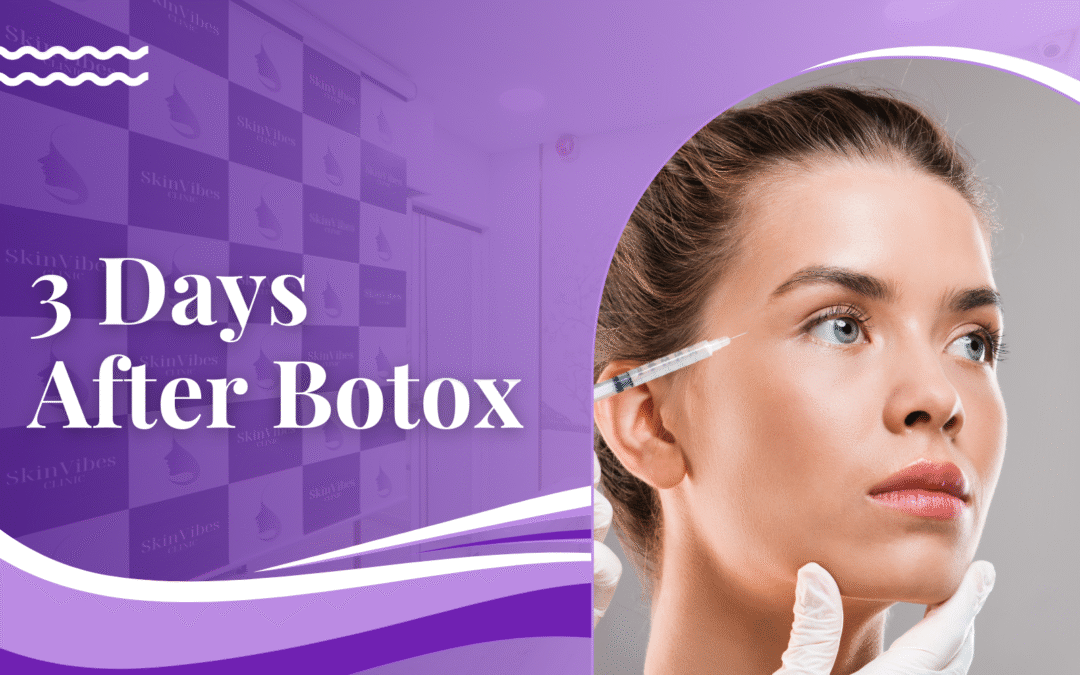 3 Days After Botox