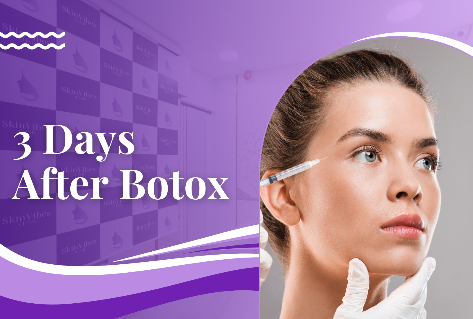 3 Days After Botox