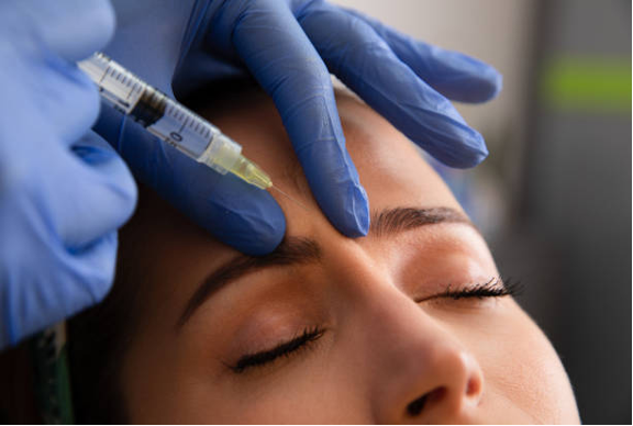 Common Side Effects at Day 3 of Botox