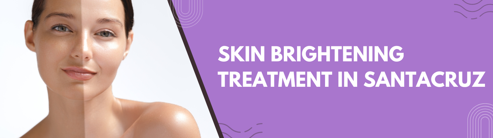 Skin brightening treatment in Santacruz Skin brightening treatment in Santacruz